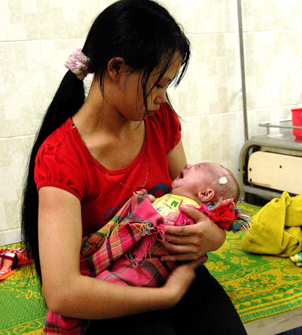 Bé Lý Thị Dương trước khi xuất viện.
