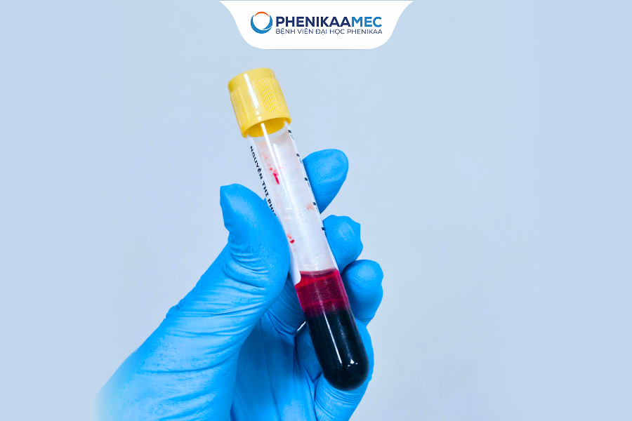 Xét nghiệm NIPT sàng lọc bất thường nhiễm sắc thể dựa trên máu của mẹ 