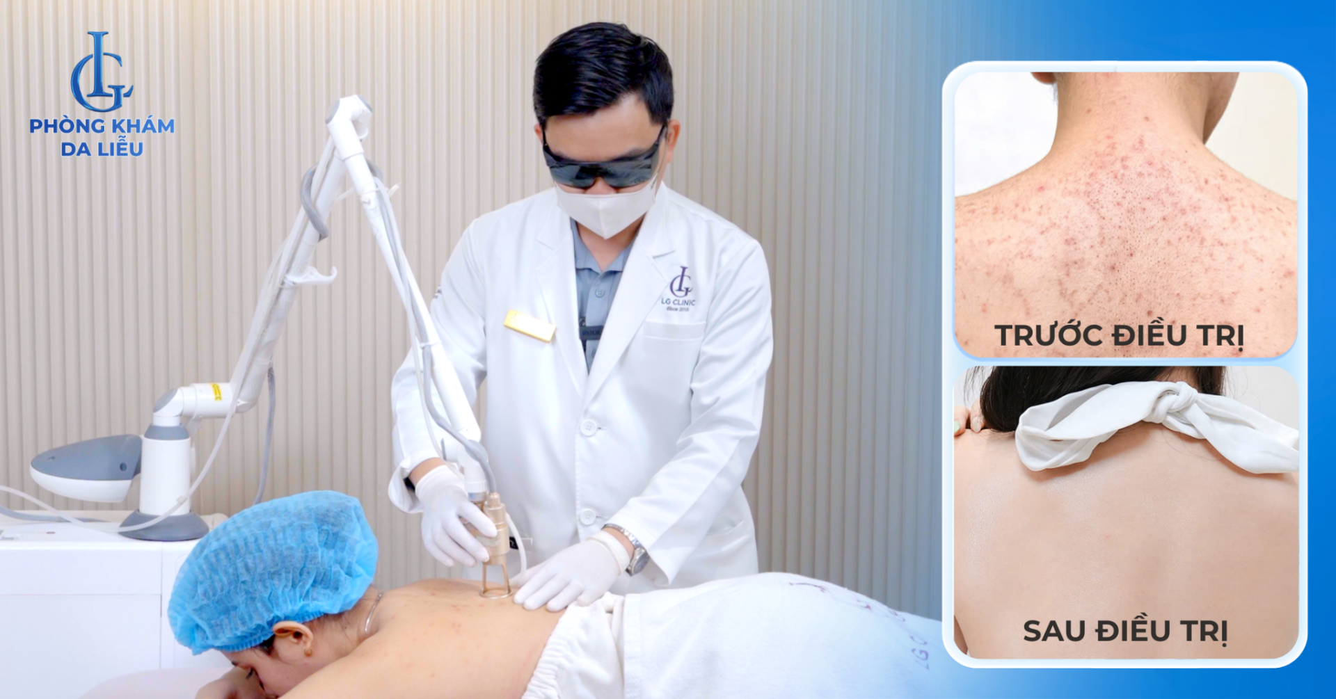 Phác đồ tại Phòng khám Da liễu LG không chỉ loại bỏ triệt để tình trạng viêm nang lông lưng mà còn cải thiện chất lượng da tổng thể