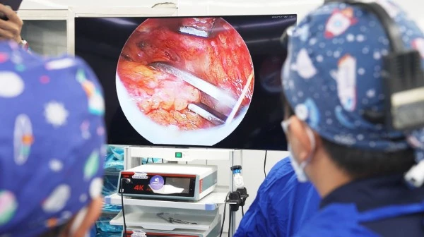 Hệ thống nội soi 4K không thể thiếu trong căng da mặt Deep Plane.