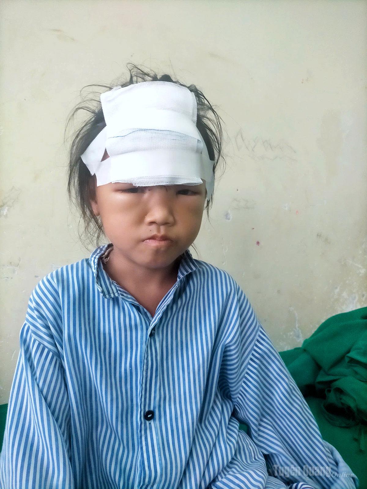 Cháu Giàng Thị Mo,  thôn Khau Rịa, xã Du Già, tỉnh Tuyên Quang đang điều trị vết thương bị chó cắn.