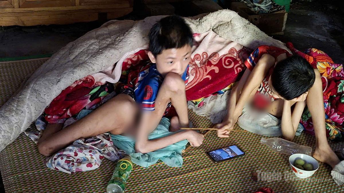 Hoàn cảnh đáng thương của cháu Đặng Phụ Quấy và Đặng Phụ Quyên, thôn Xuân Thành, xã Thông Nguyên tỉnh Tuyên Quang bị khuyết tật.