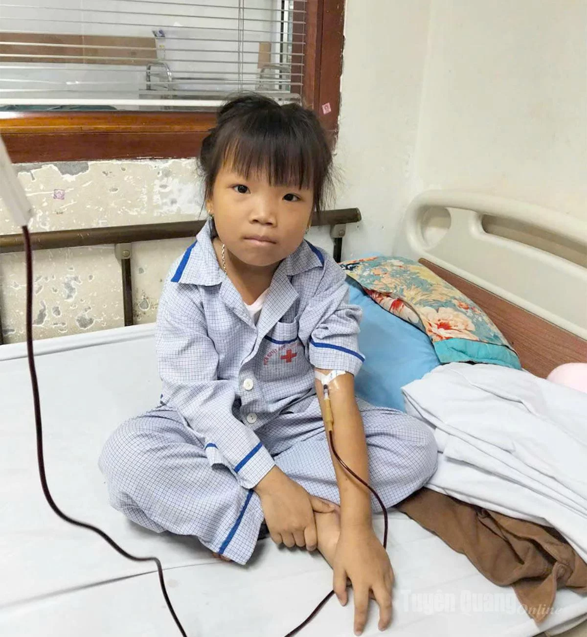 Cháu Ma Phương Thảo, thôn Lương Cải, xã Trung Sơn, tỉnh Tuyên Quang cứ 15-20 ngày lại phải đi điều trị tại Viện Huyết học Truyền máu Trung Ương – Hà Nội.