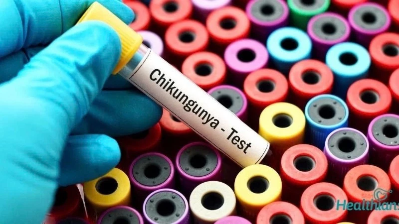 WHO bác thông tin về virus lạ gây triệu chứng ho ra máu ở Nga