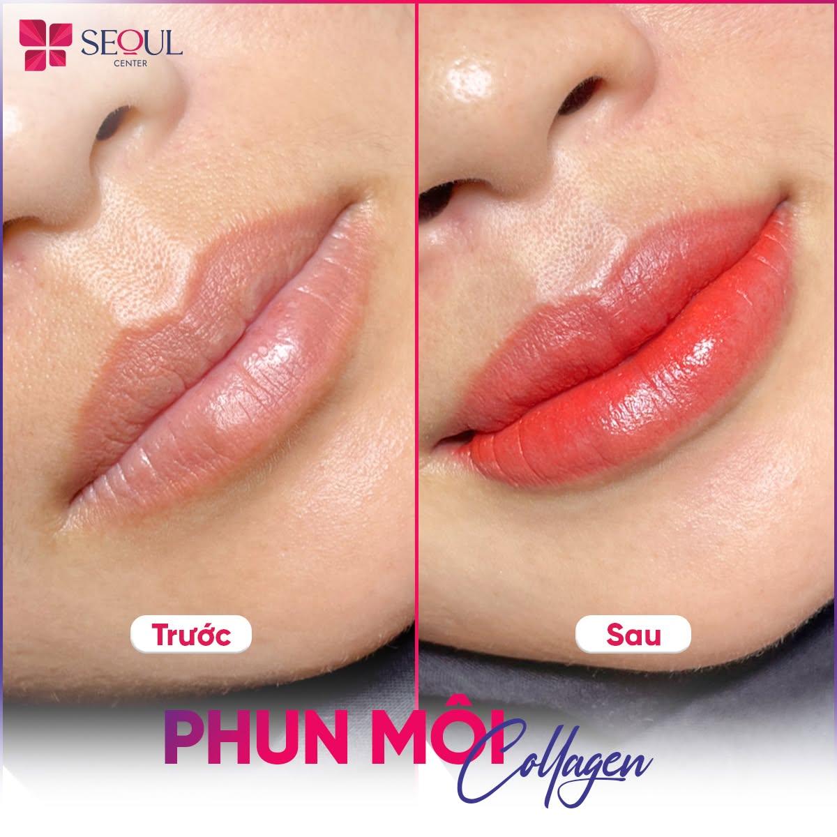 Nên chọn những cơ sở có đa dạng công nghệ phun xăm sẽ giúp bạn sở hữu đôi môi màu đỏ cam đẹp tự nhiên
