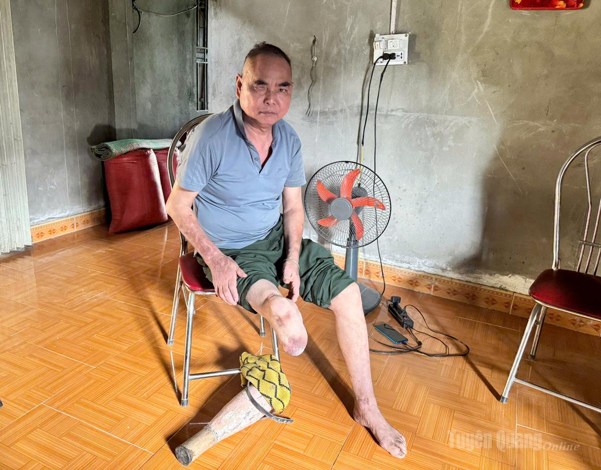 Cựu chiến binh Sùng Sào Minh, thôn Na Lan, xã Nấm Dẩn, tỉnh Tuyên Quang bị hỏng mắt phải và cụt chân phải.