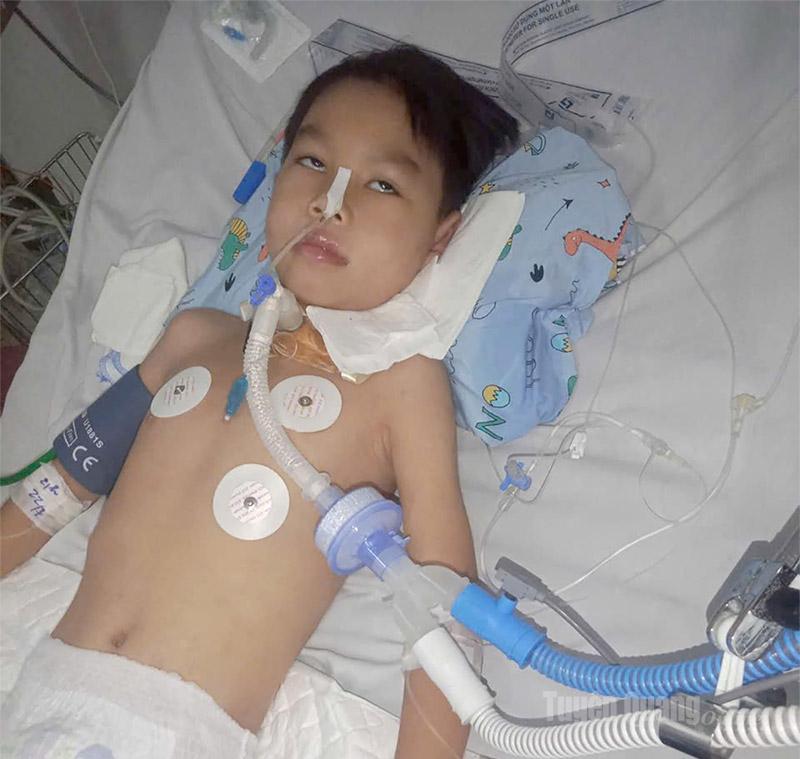  Em Lê Anh Hưng, thôn Đo, xã Bình Xa, tỉnh Tuyên Quang đang được điều trị tích cực tại Khoa Nhi, Bệnh viện Nhiệt đới Trung ương – Hà Nội.