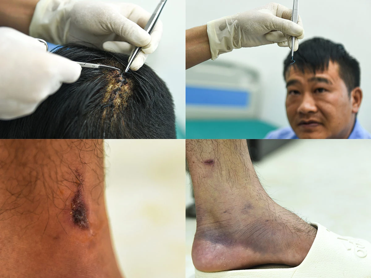 Các ca nhập viện chủ yếu là do kiệt sức, chấn thương do dẫm phải vật sắc nhọn, bê vác đồ nặng, nhiễm trùng, các bệnh ngoài da do ngâm nước lâu. Hầu hết các chiến sĩ điều trị trong thời gian ngắn xong lại gấp rút lên đường thực hiện nhiệm vụ. Những trường hợp nặng hơn được kịp thời chuyển tuyến và điều trị theo dõi sát sao.