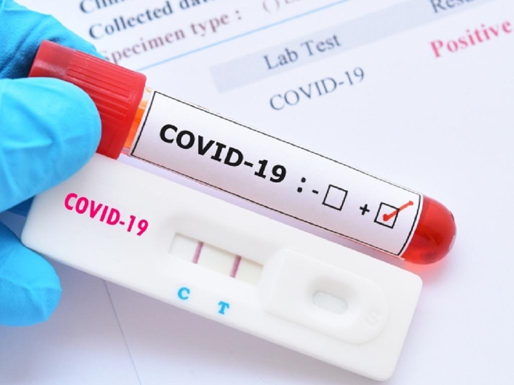Nếu tiếp xúc với F0, chúng ta phải xét nghiệm Covid-19